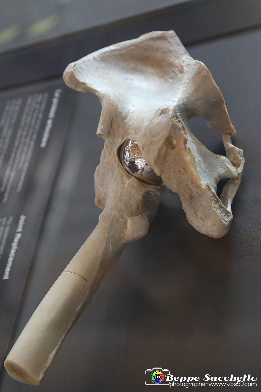 VBS_3060 - Protesi articolare - Mostra Body Worlds.jpg